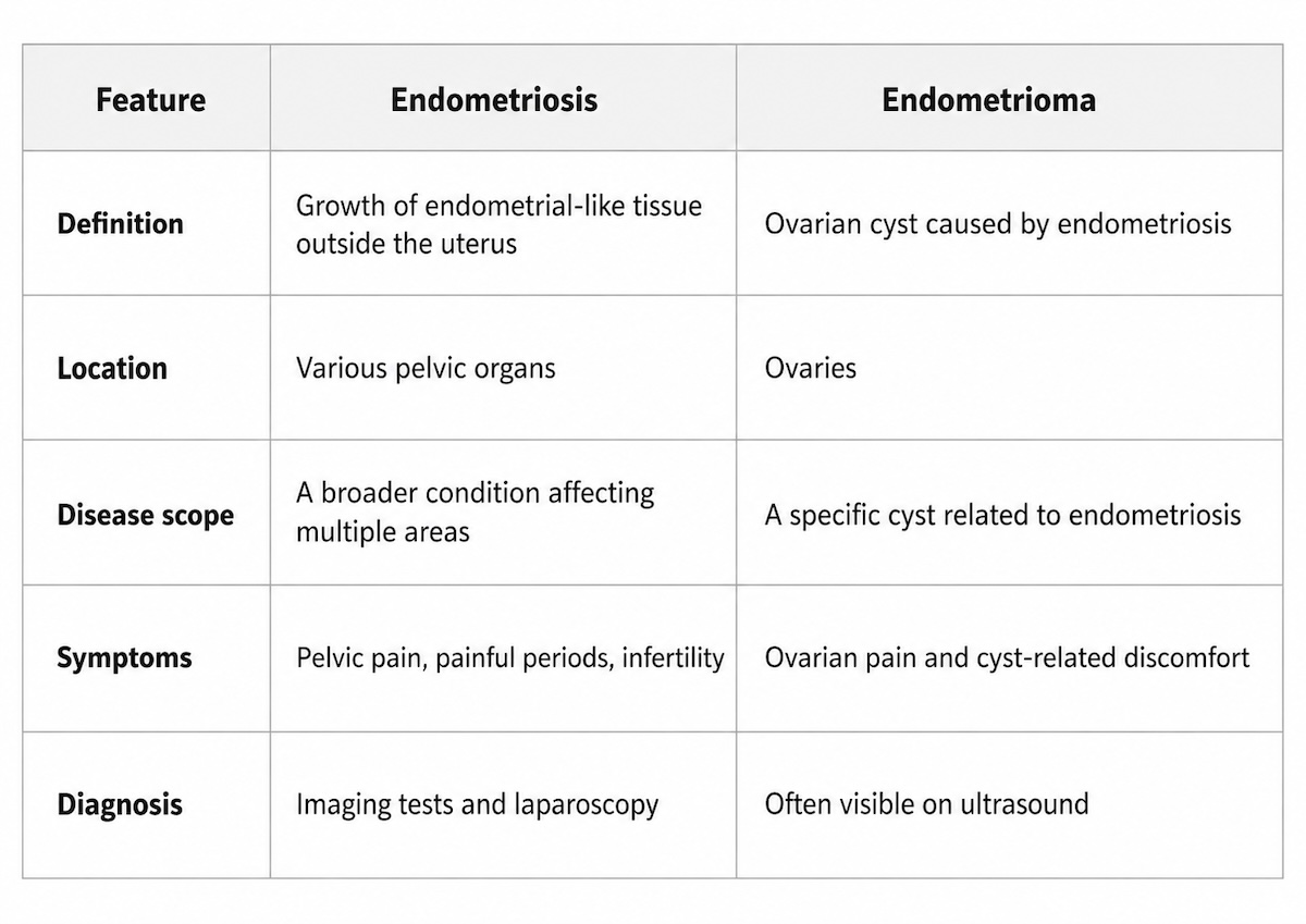 endometriosis vs endometrioma